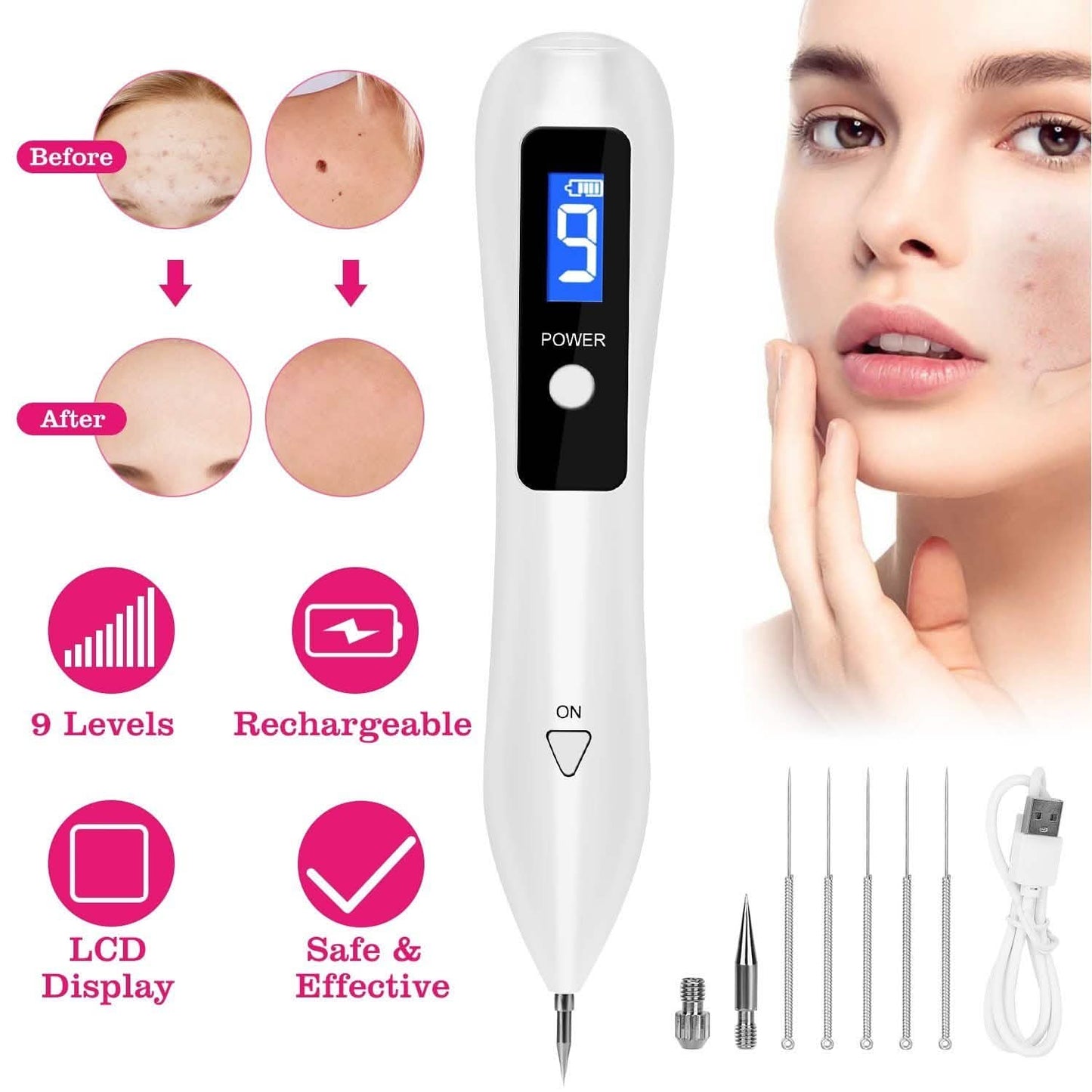 Portable Skin Tag Repair Kit with 6 Replaceable Needles
