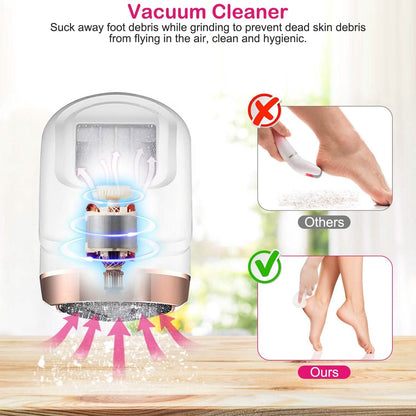 17-Pieces Set: Electric Foot Callus Remover with Vacuum Foot Grinder Rechargeable