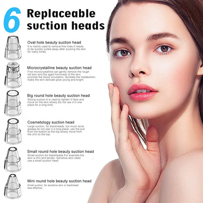 Blackhead Remover Pore Vacuum Cleaner - Electric USB Extractor with 5 Probes - White