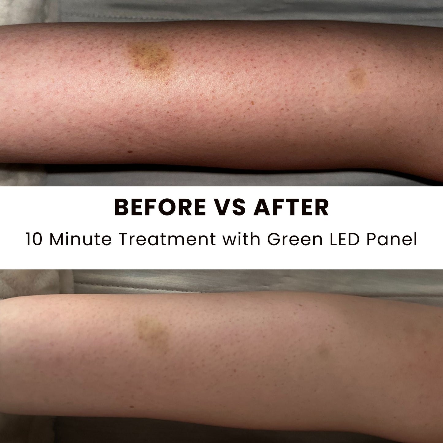 Illuminate Green V1 – Green Light Therapy Panel