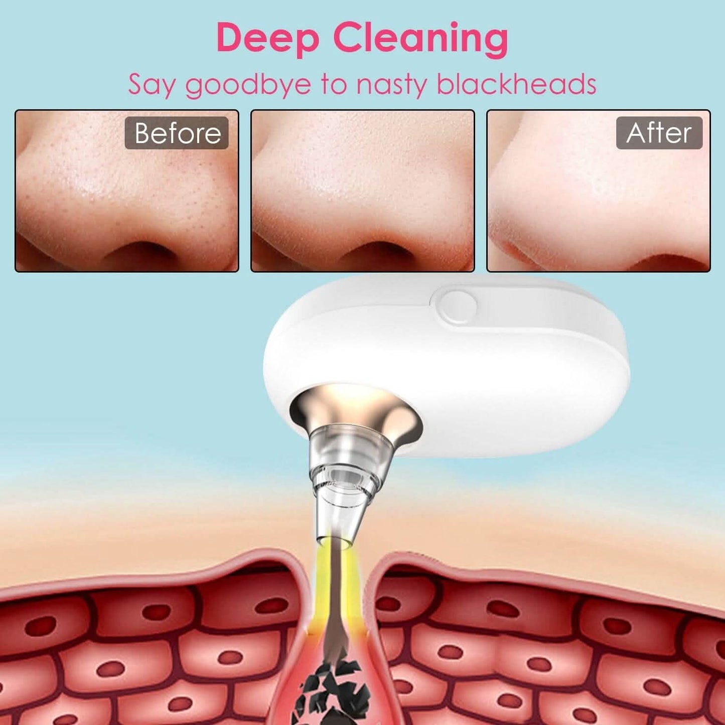 Electric Blackhead Comedone Extractor Tool Facial Pore Cleaner
