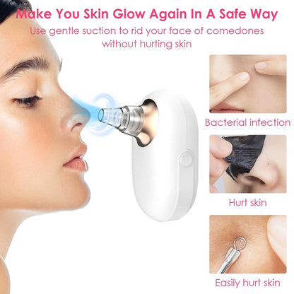 Electric Blackhead Comedone Extractor Tool Facial Pore Cleaner
