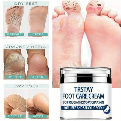 Trstay Foot Care Cream50g/ Foot Care Cream 40 Urea And Salicylic Acid